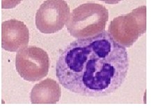 kalıp, küf içeren bir resimAçıklama otomatik olarak oluşturuldu